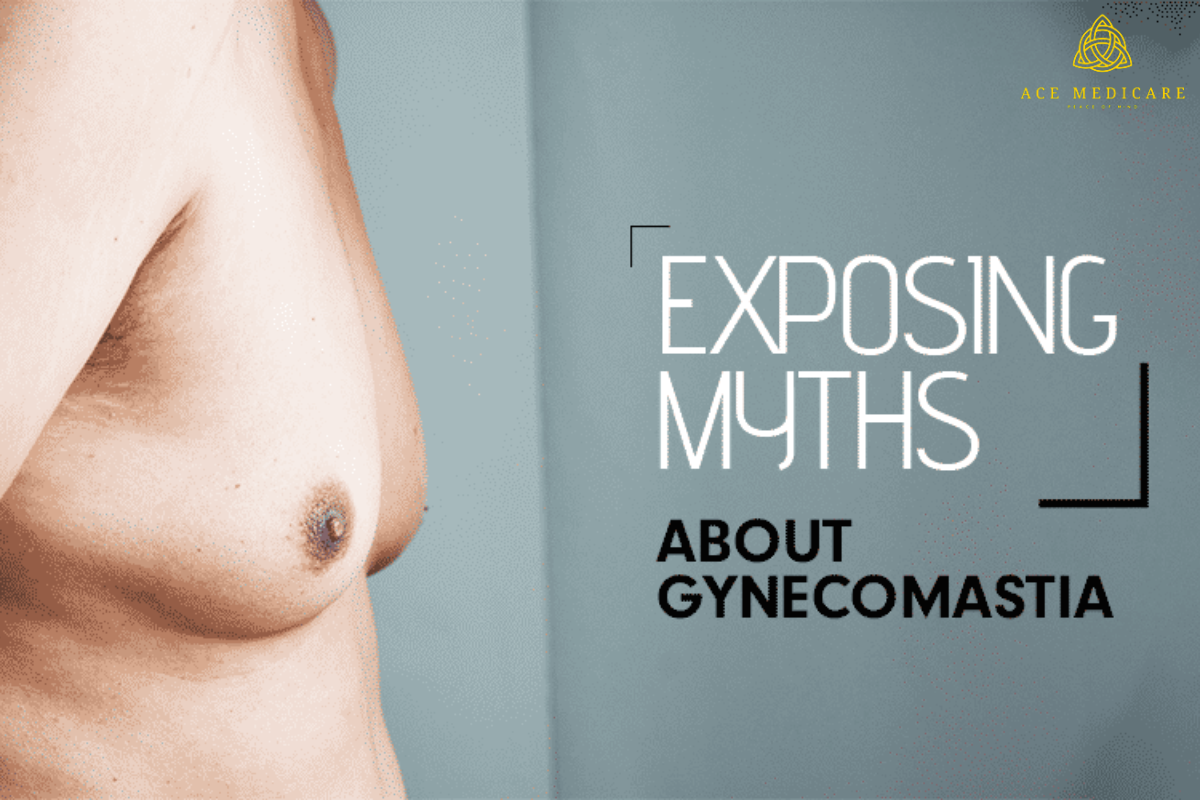 Debunking Myths About Enlarged Male Breasts